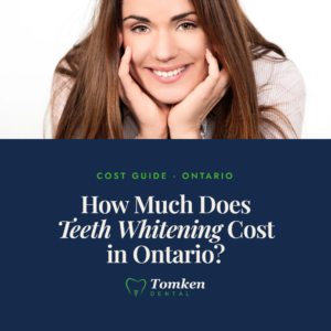 Smiling woman resting chin on hands - teeth whitening cost guide for Ontario, Tomken Dental