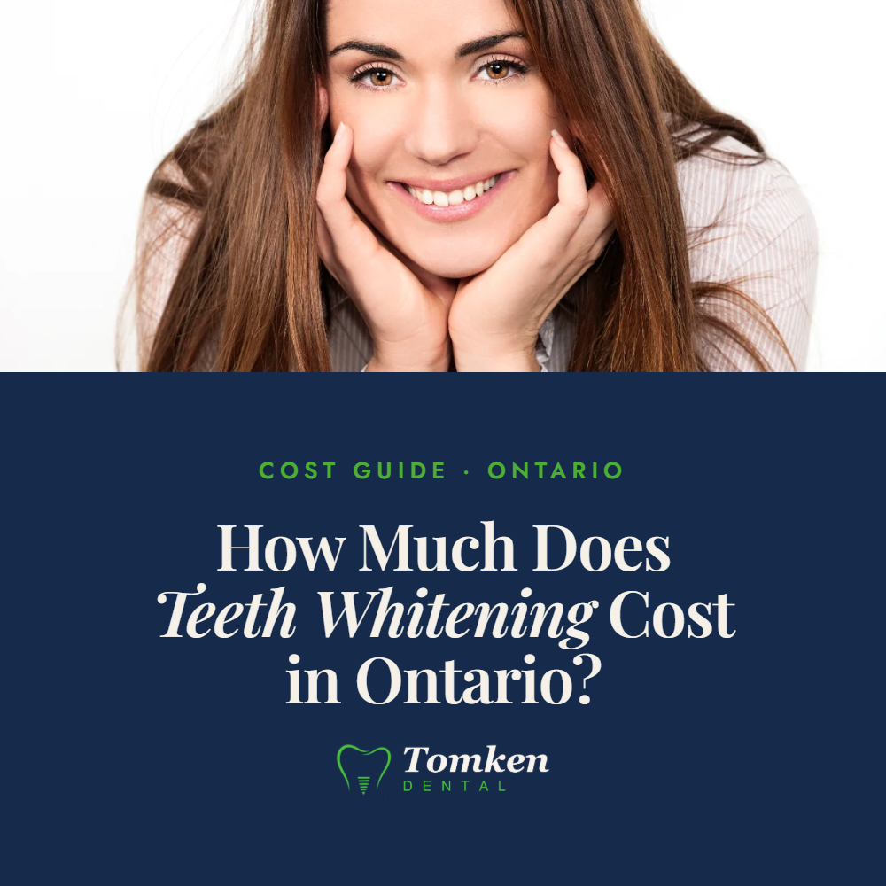 Smiling woman resting chin on hands - teeth whitening cost guide for Ontario, Tomken Dental