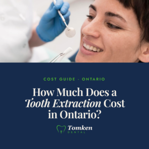 Close-up of dentist examining patient's smile with dental tools - tooth extraction cost guide Ontario, Tomken Dental