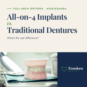 Full-arch implant model at Tomken Dental in Mississauga