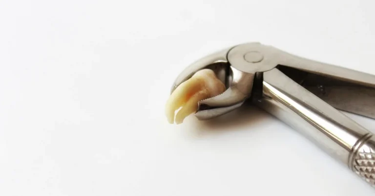 extracted tooth
